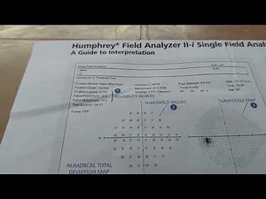 how to read visual #fieldreport chart