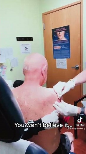 Mid Length Video of Abscess I&D at Las Vegas Dermatology