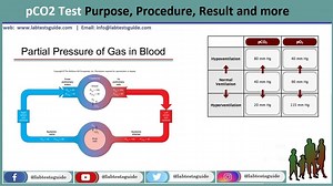 pCO2 (Partial Pressure of Carbon Dioxide): Defination, Test Purpose, Procedure, Result and more