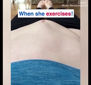 Mother shows 'Alien-like' post baby stomach contortions