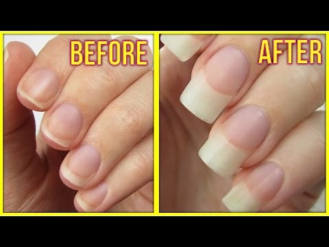 5 Ways to Grow Your Nails FAST!