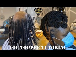 Loc Toupee Install (Tutorial)