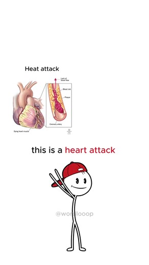 What is the difference between these english terms? Learn these english terms easily. Follow for more content like this if you enjoy learning English! #englishvocabulary #englishlearning #englishtips #wordloop #wordlooop