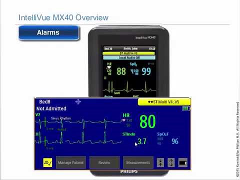 Philips IntelliVue MX40 Patient Monitor - Alarms
